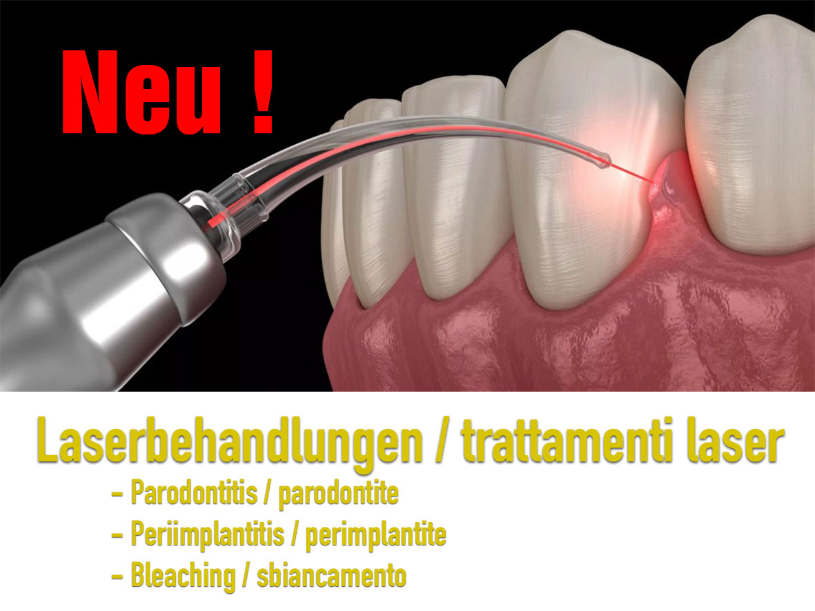 Laserbahandlung